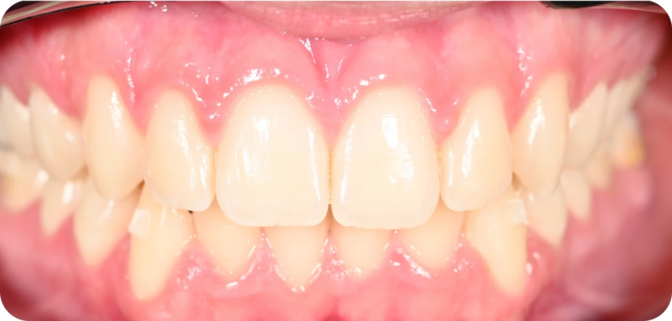 Processed - Man holding beer