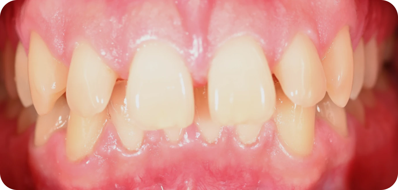 Original - Man holding beer