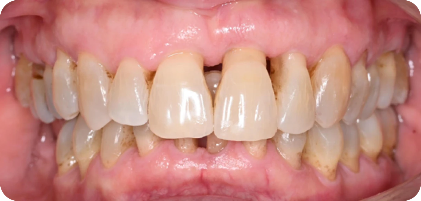 Original - Man holding beer