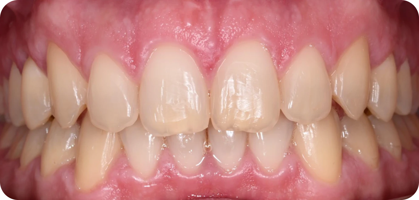 Processed - Man holding beer