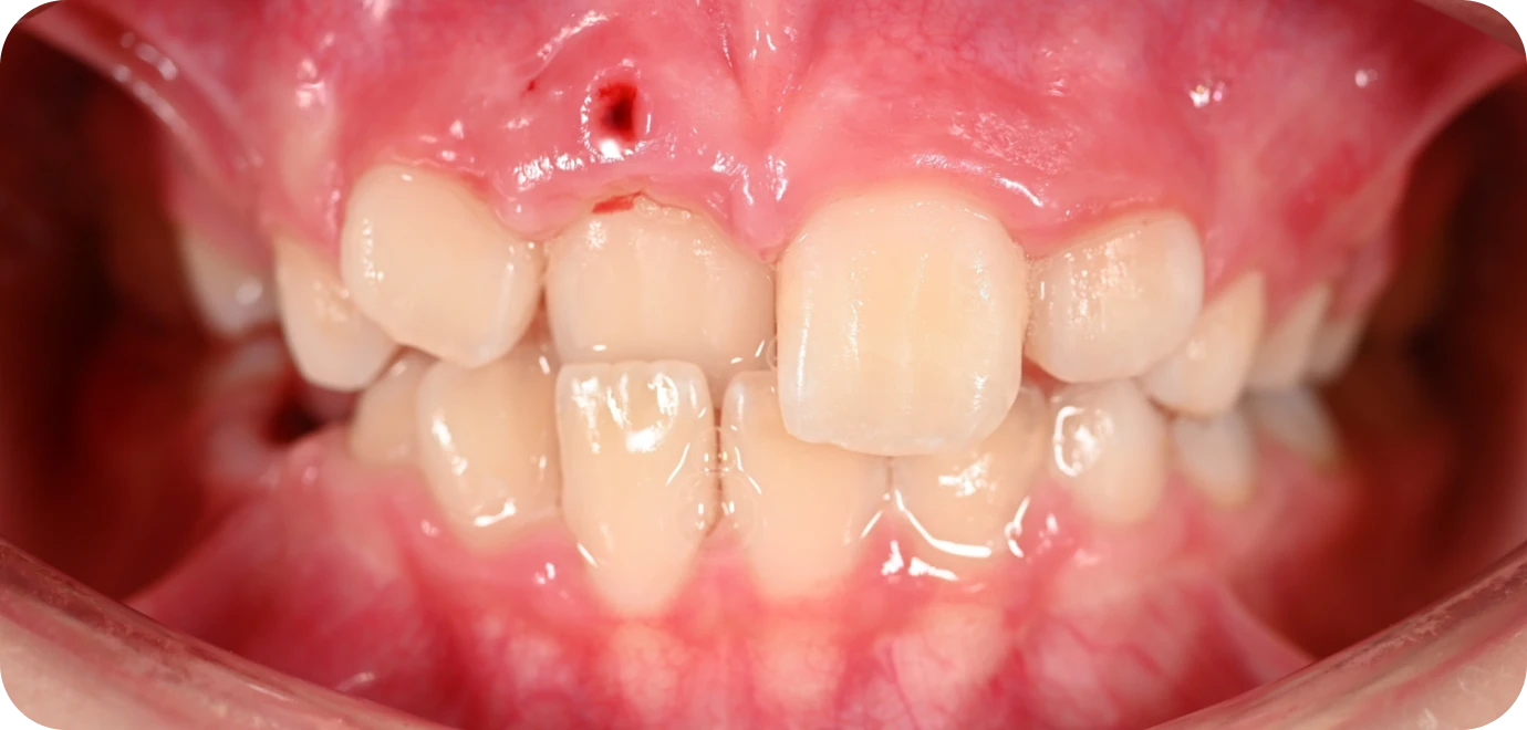 Original - Man holding beer