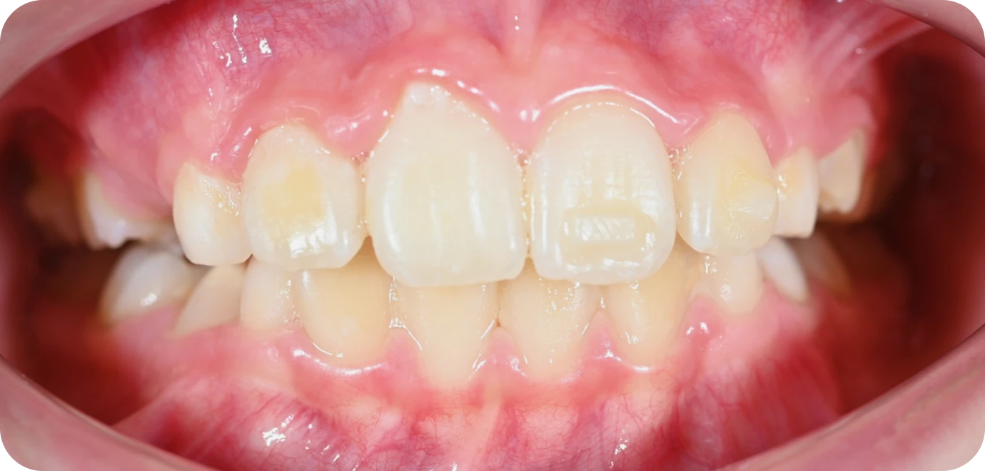 Processed - Man holding beer