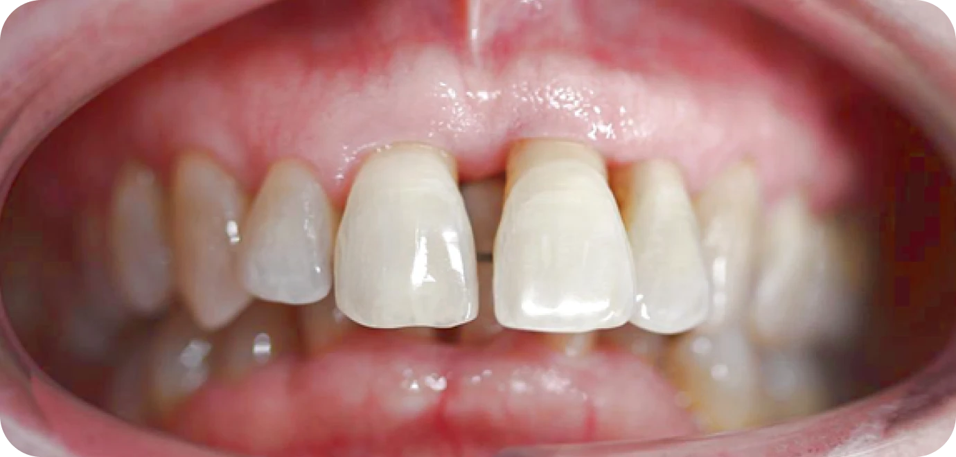 Processed - Man holding beer