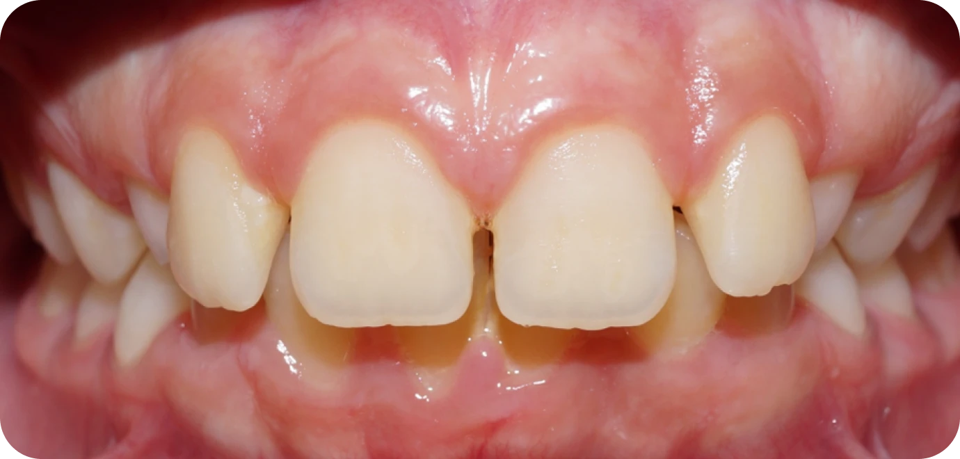 Original - Man holding beer