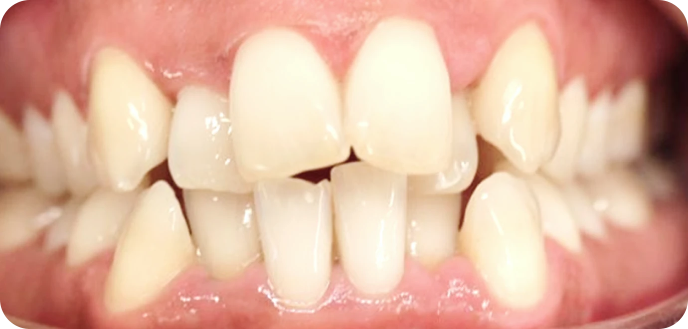 Original - Man holding beer