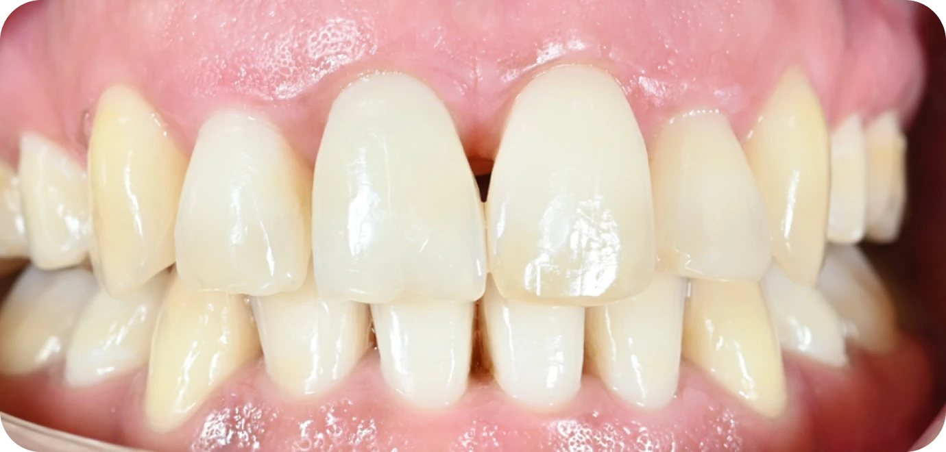 Processed - Man holding beer